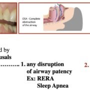 an educational slide of airway dentistry showing effects of sleep apnea